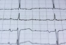 solar stream future technology